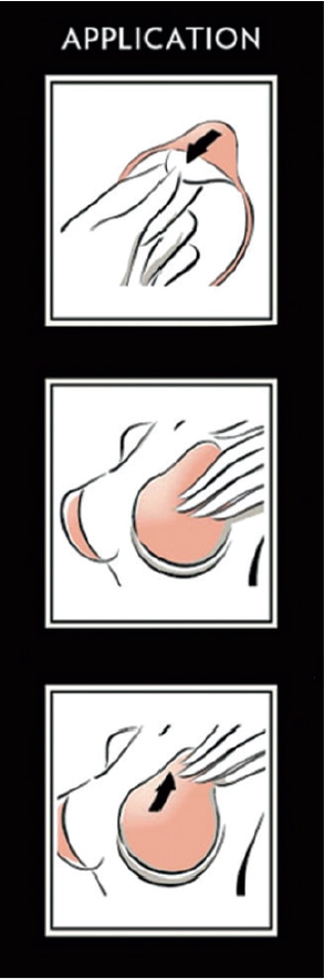 Silicone Instant Breast Lift